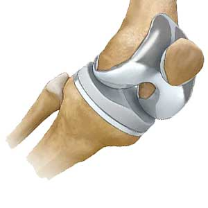 دکتر سلیم خانی